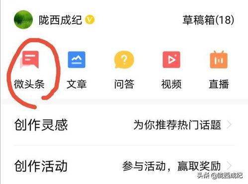 今日头条小呆瓜,今日头条的萌宠新宠，带你领略趣味生活