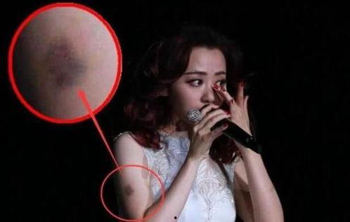 明星网红骨折视频大全集,明星网红骨折视频大全集回顾