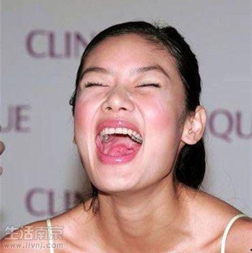 蛀牙的明星网红是谁,揭秘明星蛀牙背后的故事